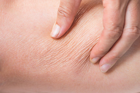 How to remedy a rough and dull winter skin