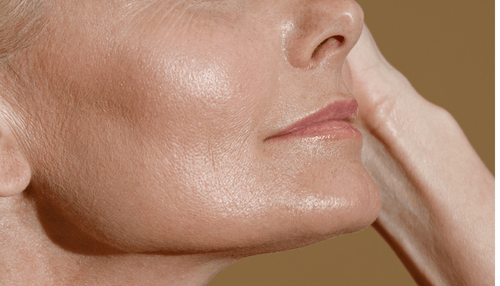 Menopause and The Skin